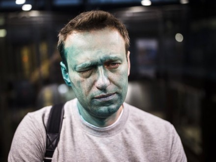 В РФ взбудоражили уголовное девало по факту нападения на А.Навального